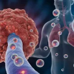 Cancer metastasis bubbles reveal how tumors secretly prepare distant organs for invasion