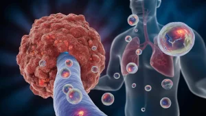 Cancer metastasis bubbles reveal how tumors secretly prepare distant organs for invasion